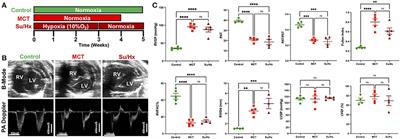Comparative analysis of right ventricular metabolic reprogramming in pre-clinical rat models of severe pulmonary hypertension-induced right ventricular failure
